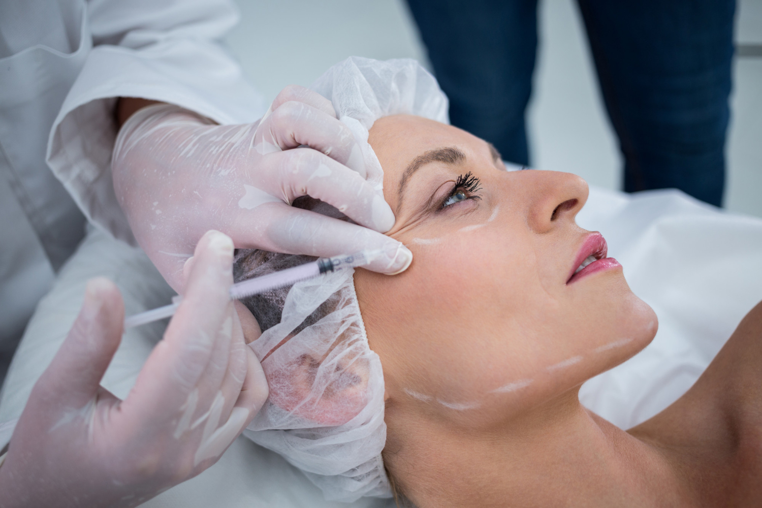 Botox / Dysport